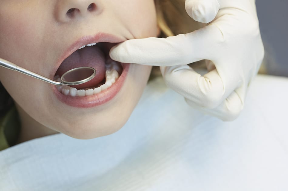 dentist checking inside backteeth of a person