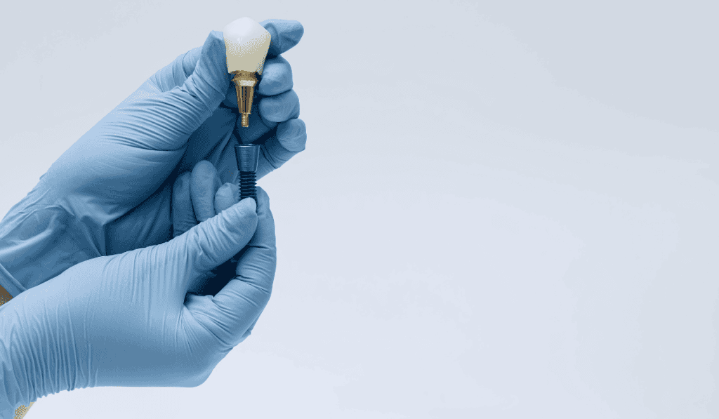 dental implants for older adults at Highland Woods Dentistry London ON